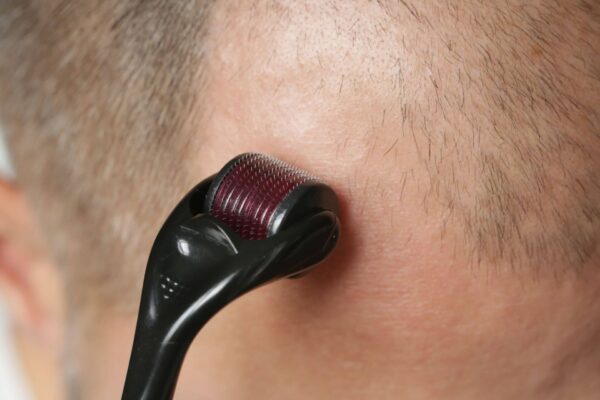 Hair Growth and Strengthening Elixir - Image 7