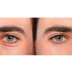 Under Eye Treatment Elixir