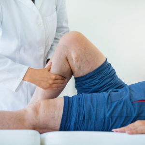 Forces of Nature Varicose Vein Defense Elixir