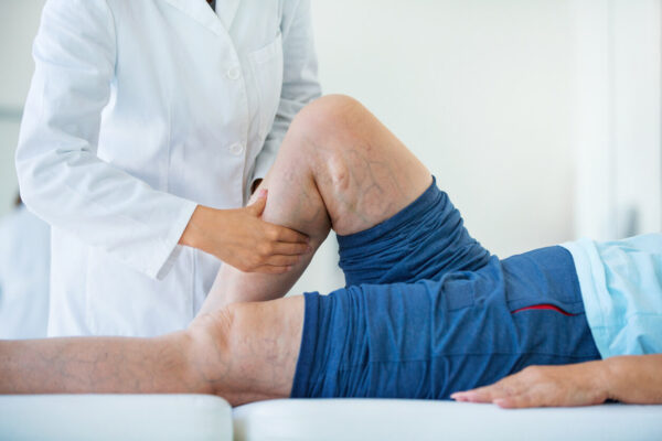 Forces of Nature Varicose Vein Defense Elixir