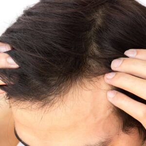 Intense Scalp Treatment Elixir