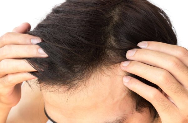 Intense Scalp Treatment Elixir