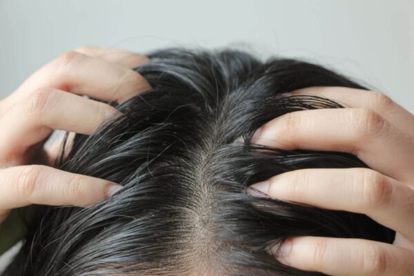 Intense Scalp Treatment Elixir - Image 2